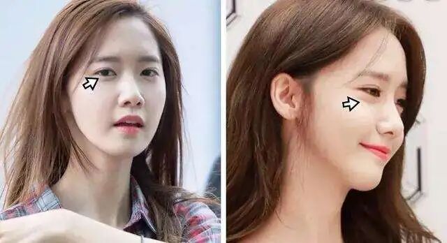 林允儿护肤步骤分享_林允儿素颜皮肤管理_女明星中性皮肤